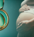 גירוי יתר שחלתי - תמונת המחשה